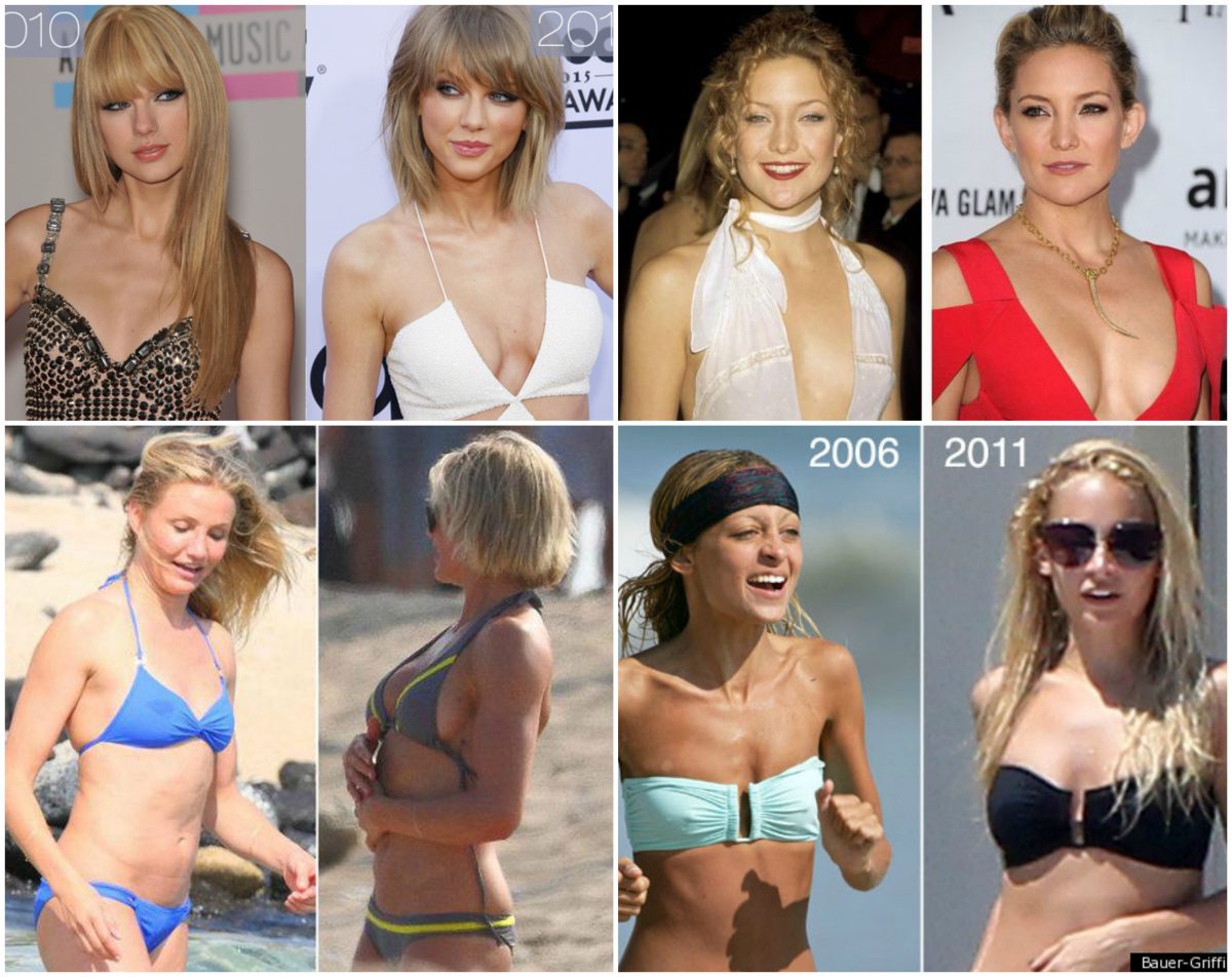 Small Breast Implants - Why They Are Trending